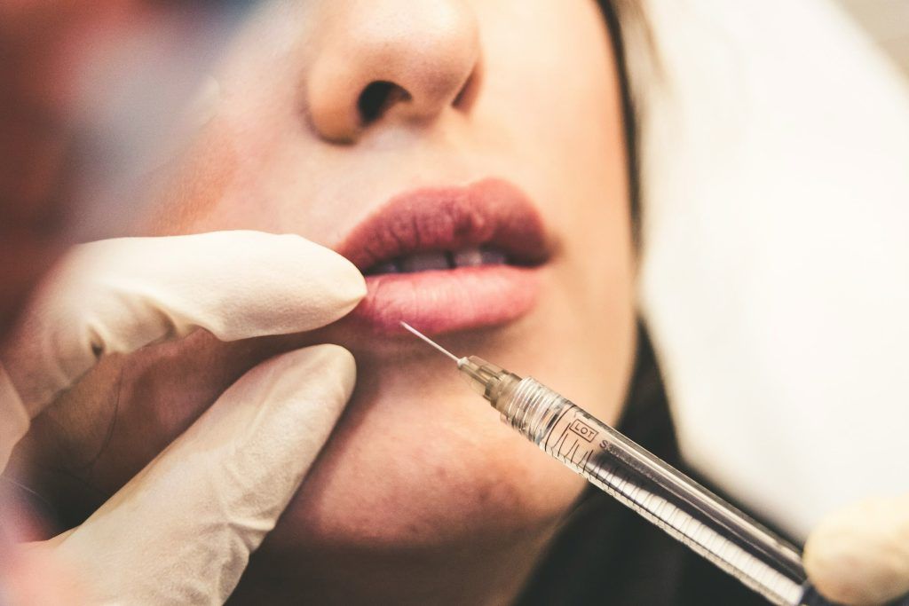 Mujer haciéndose un aumento de labios con ácido hialurónico