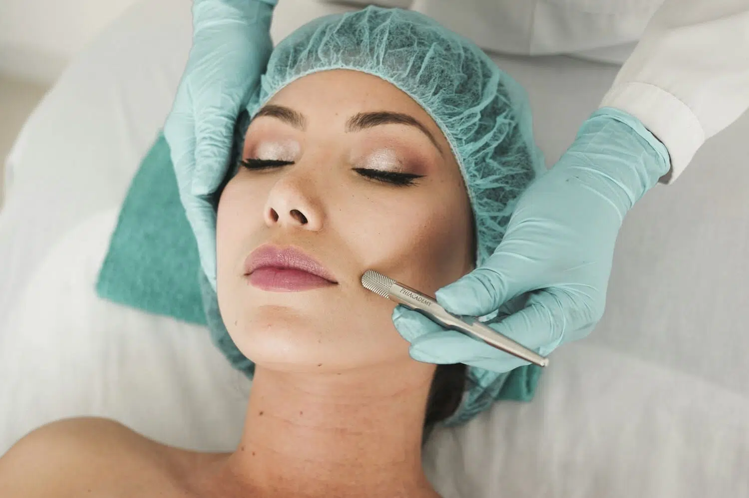 Síndrome overfilled facial o exceso de relleno facial: qué es y cómo evitarlo