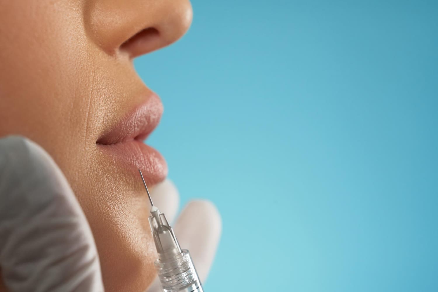 ¿Cómo eliminar los rellenos permanentes en los labios?