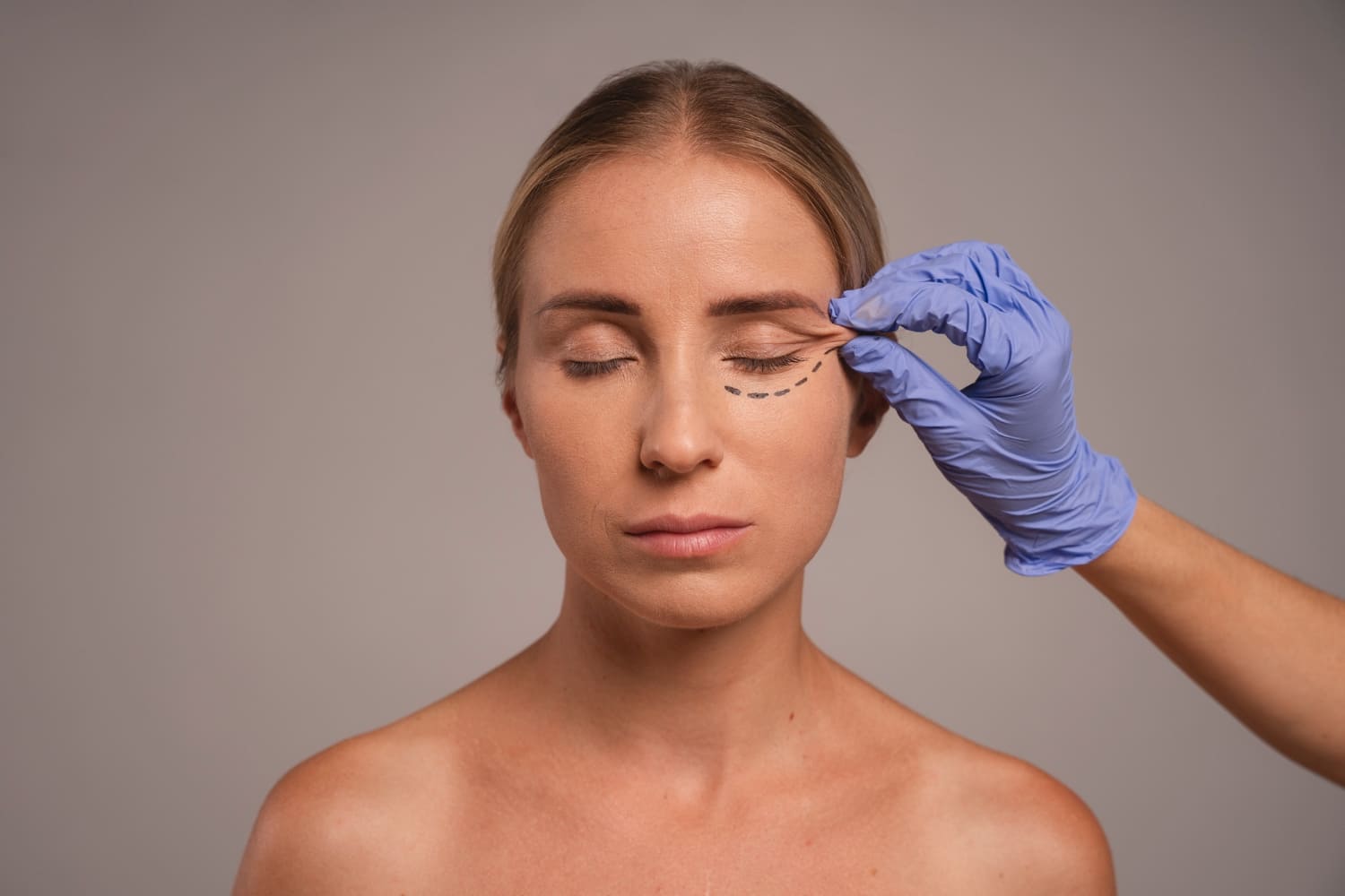 tratamientos para eliminar las ojeras