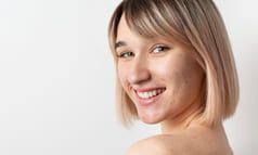 cicatrices acne