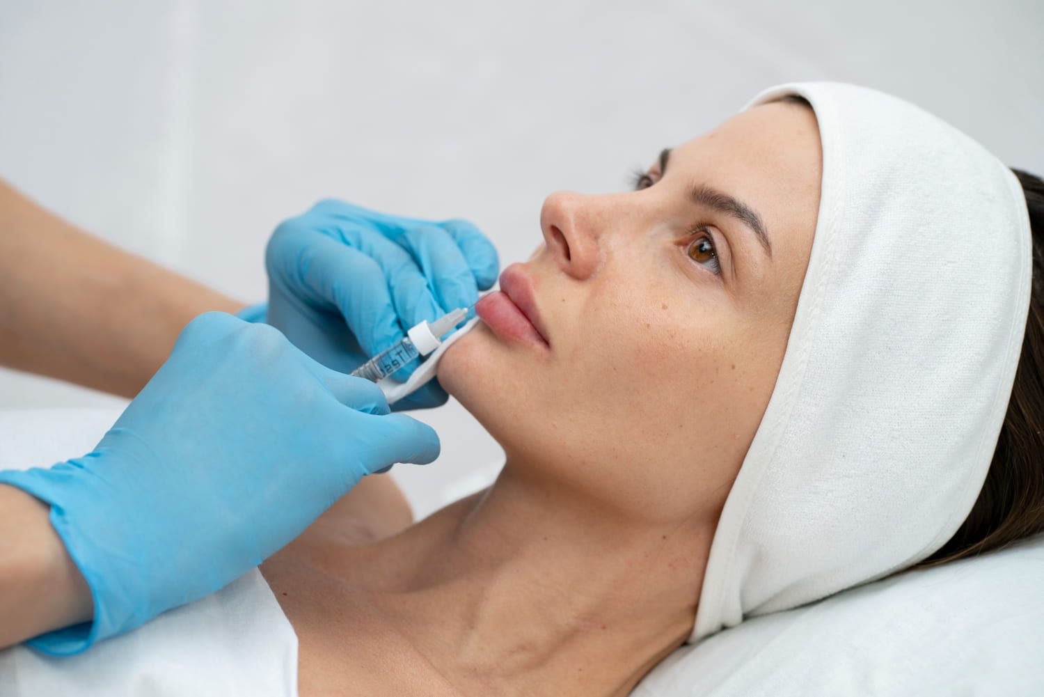 lifting de labios a mujer en madrid
