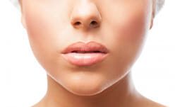 lip lift