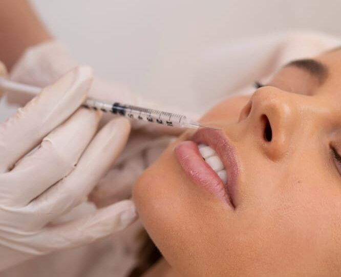 lip lift en madrid