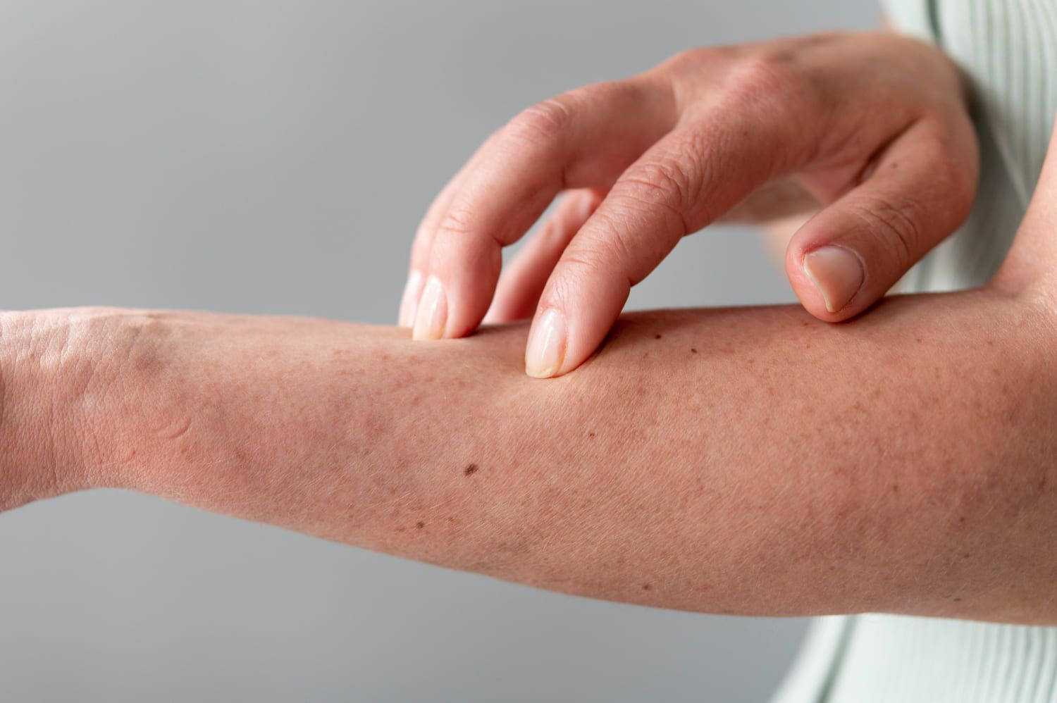 ¿Qué es un seroma? Causas, síntomas, tratamiento y cuánto tarda en reabsorberse